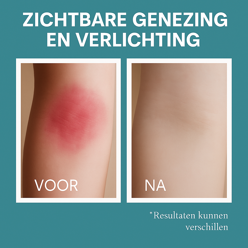 Sea Soothing - 100% Natuurlijk Zeewater tegen Eczeem